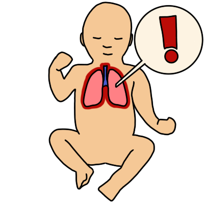 an infant with beige skin and pink lungs outlined in red. a white circle with a red exclamation mark in it connects to the lungs.